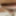 男性の足の裏の写真2