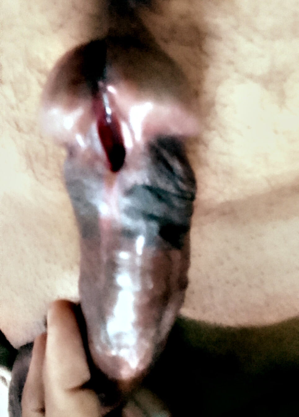 Cock subincision 