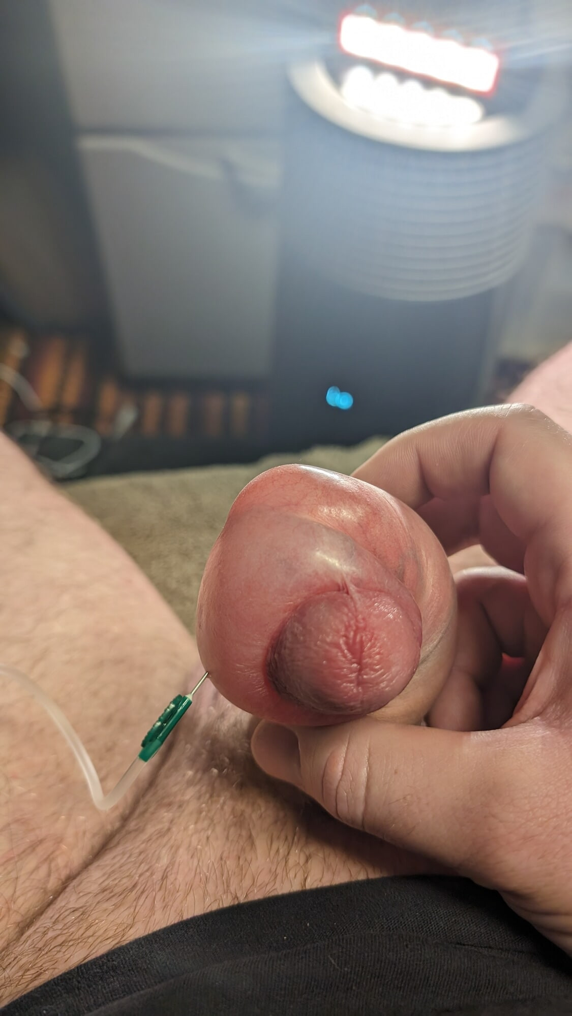 Saline Foreskin 
