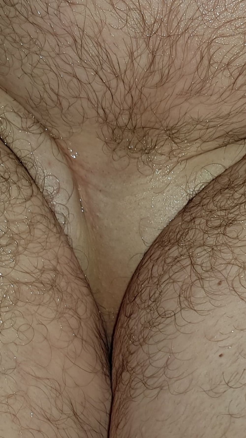 Shaved #36