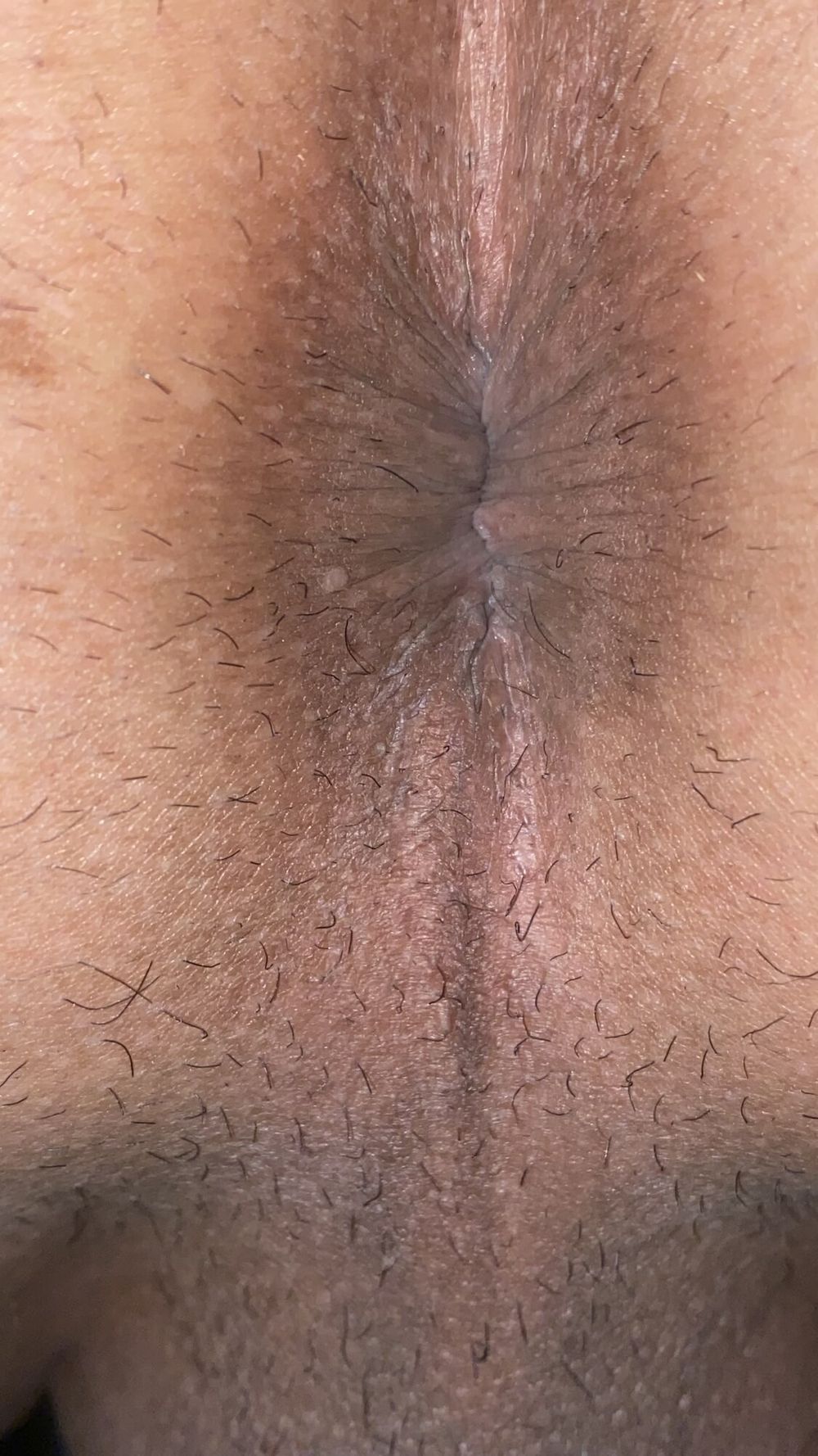 Close-up of a man&#039;s anus #20