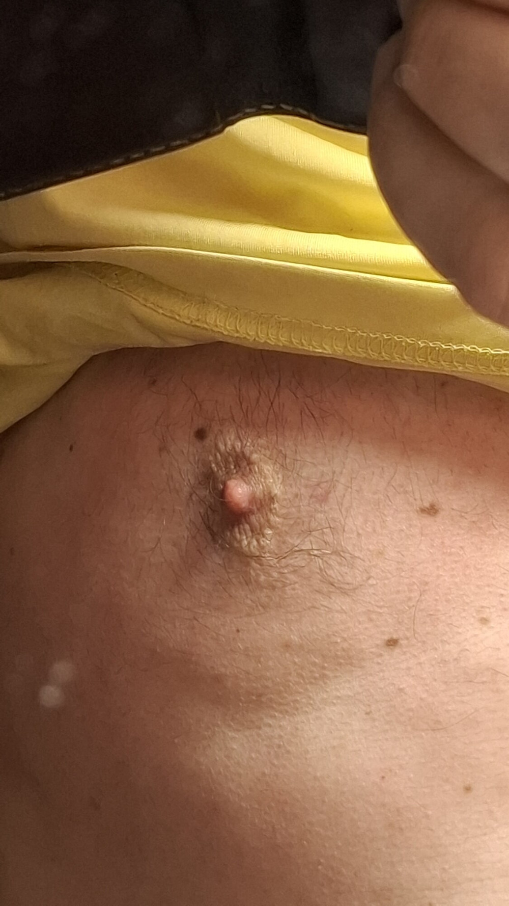 Nips #2