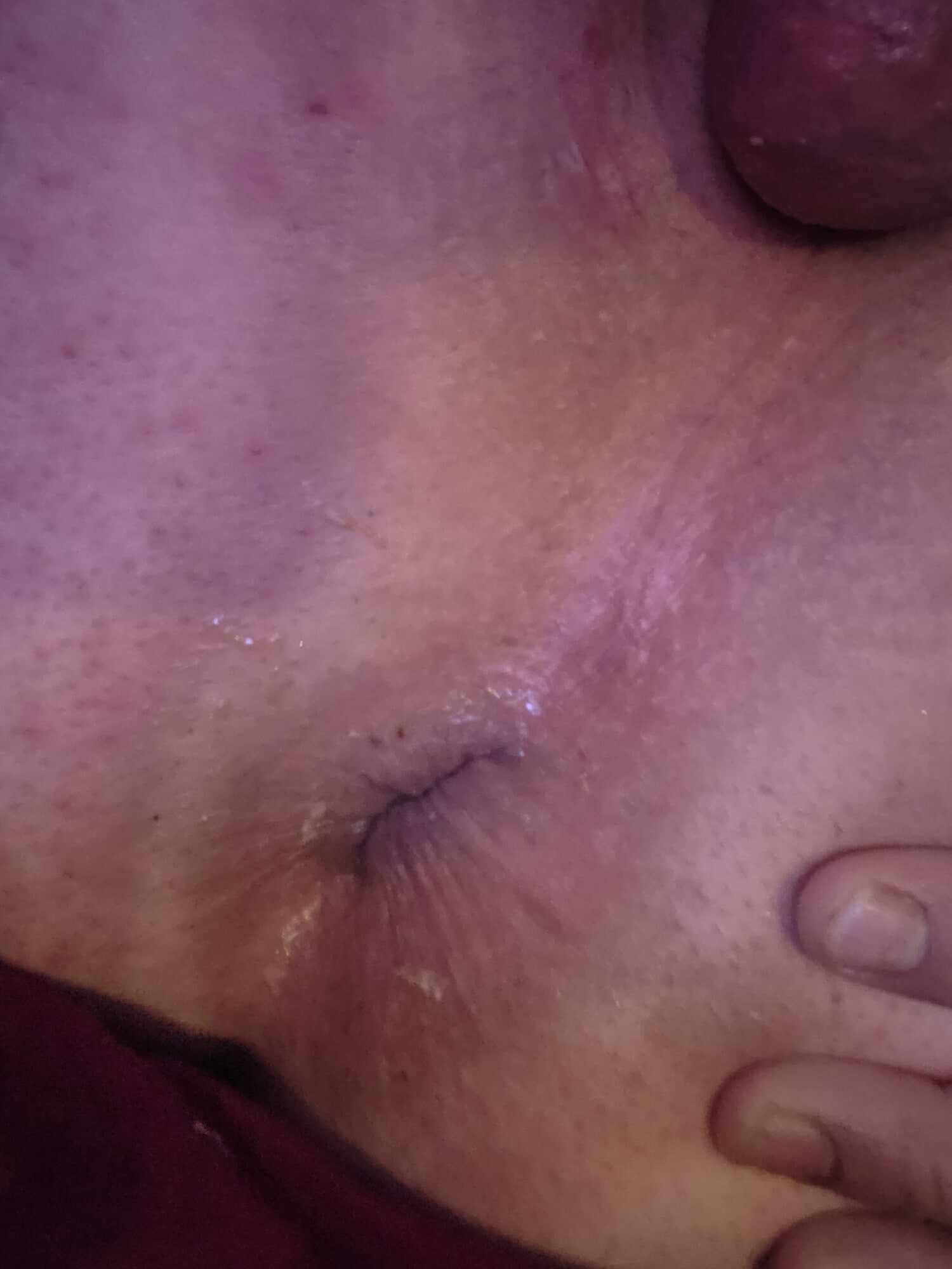 My Lovely Ass and Hole