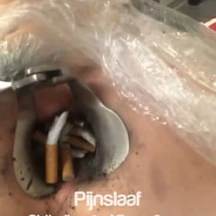 Fire torture 
