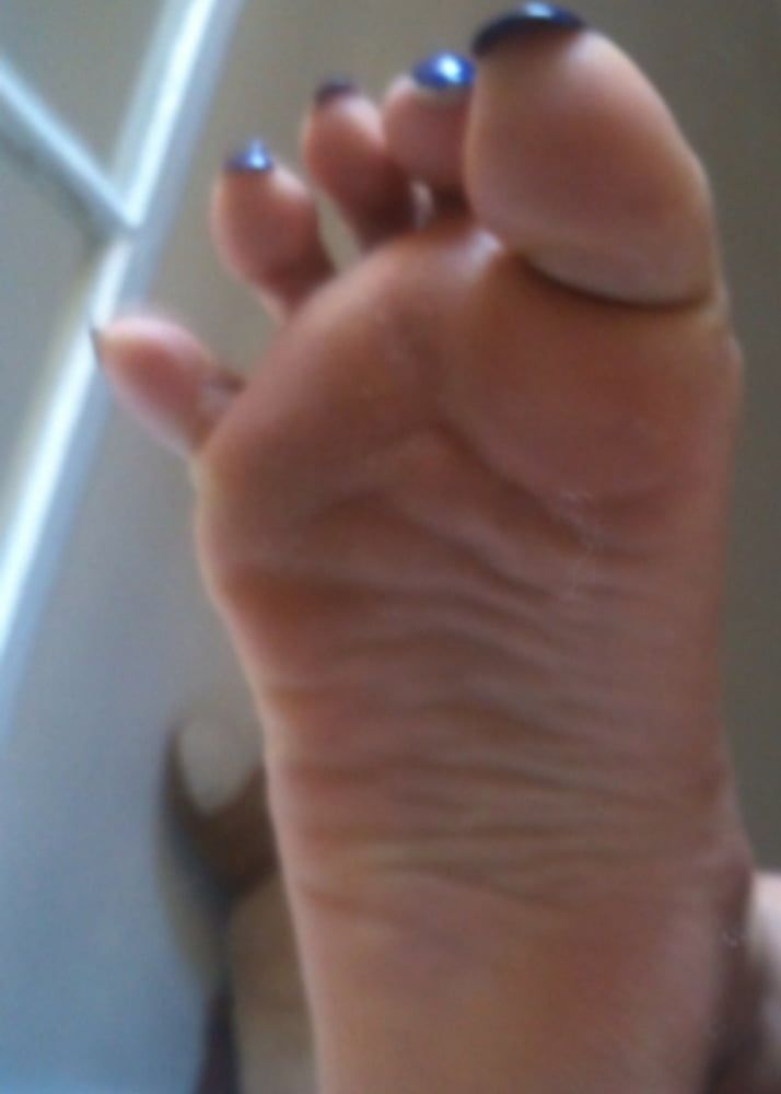 blue toenails and soles feet after day at beach  #23