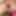 Anal