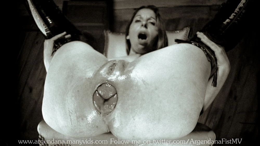 EXTREME PROLAPSE FETISH #41