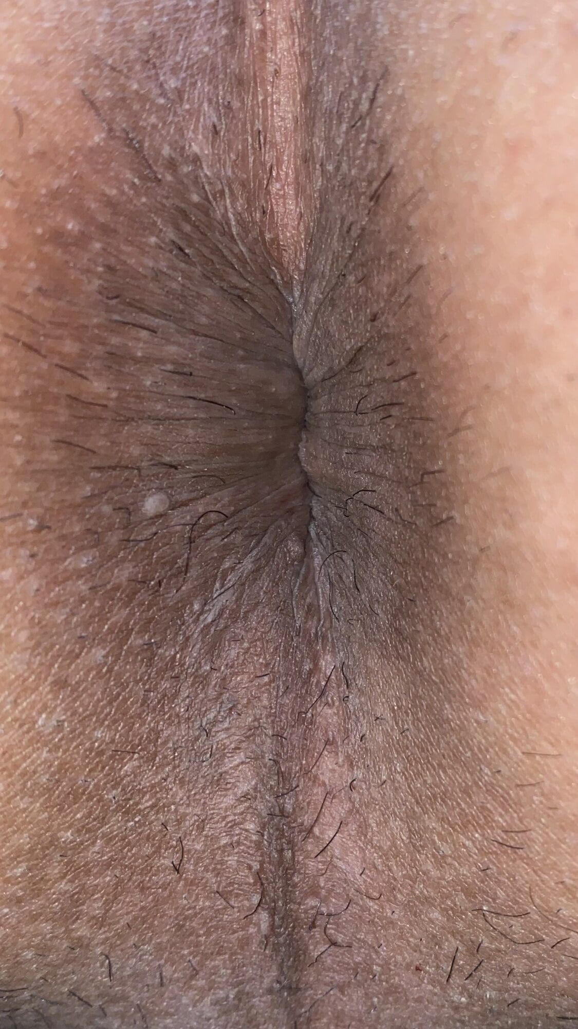 Close-up of a man's anus #10