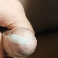 Orgasmus