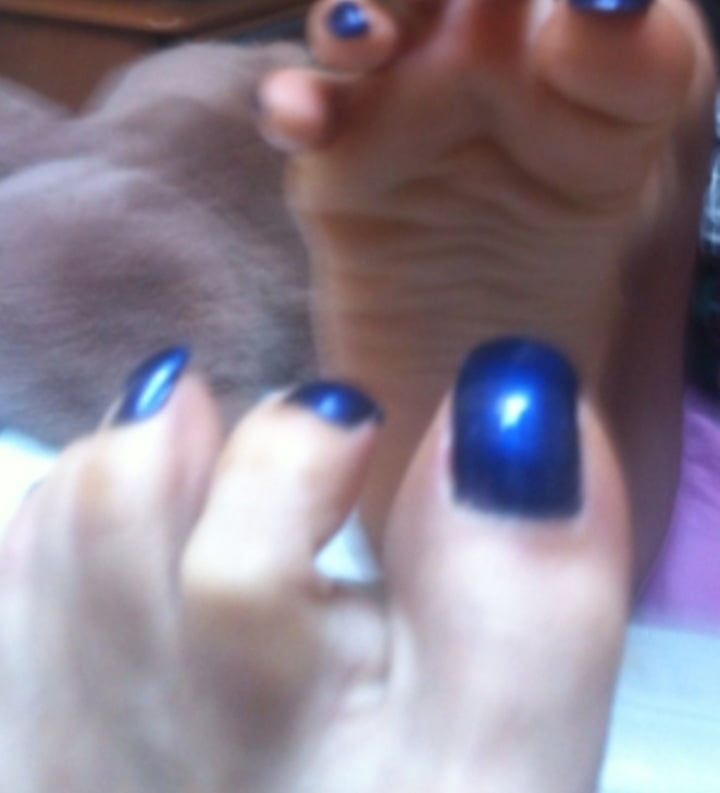 blue toenails and soles feet after day at beach  #33