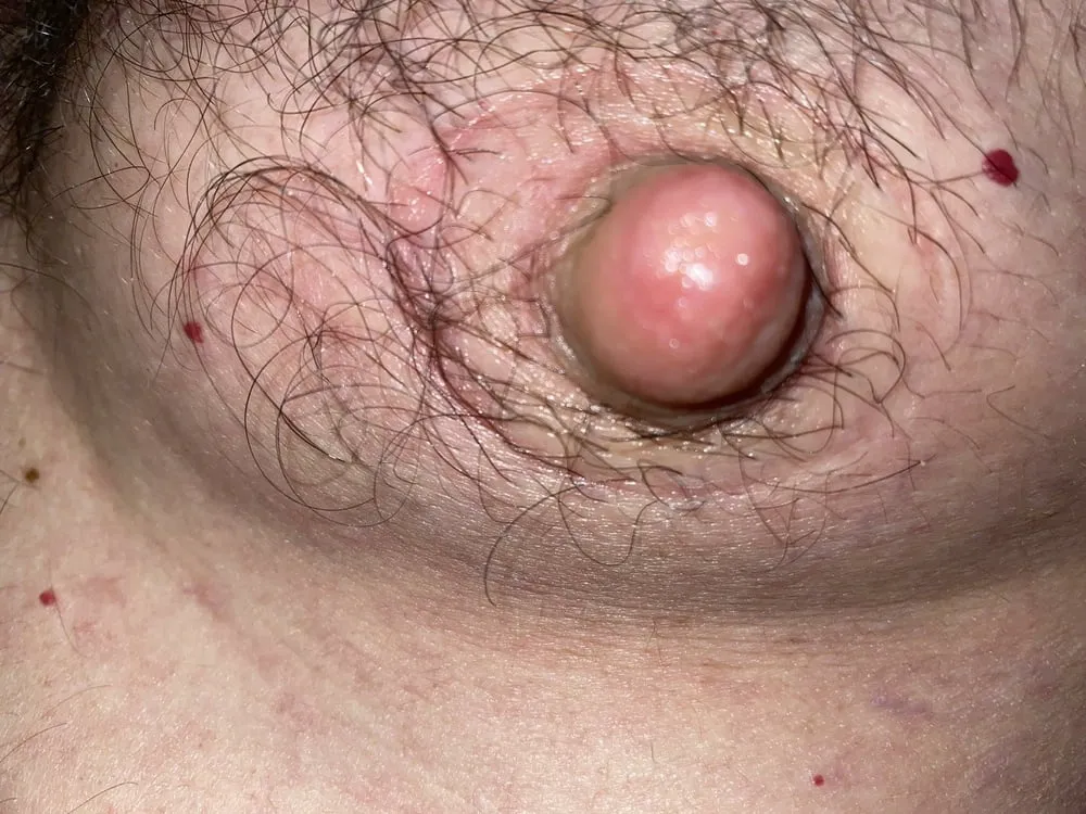 Nipples after wearing size 4 Supple Cups overnight 