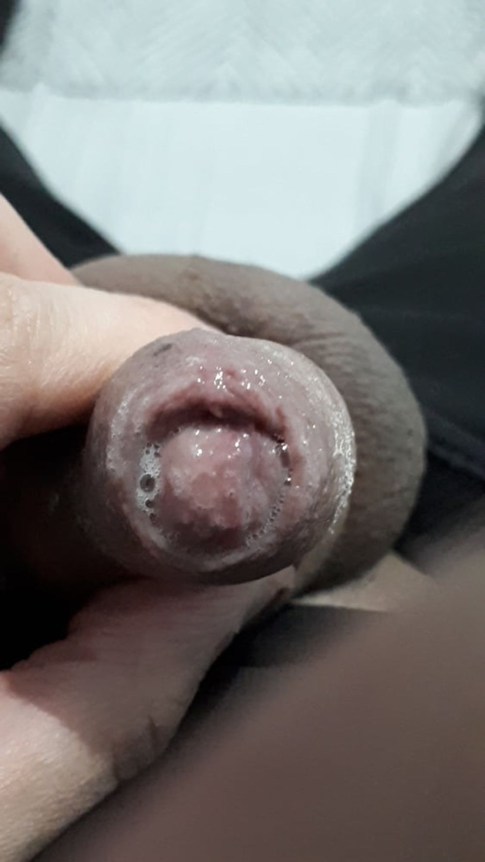 WetForeskin #19