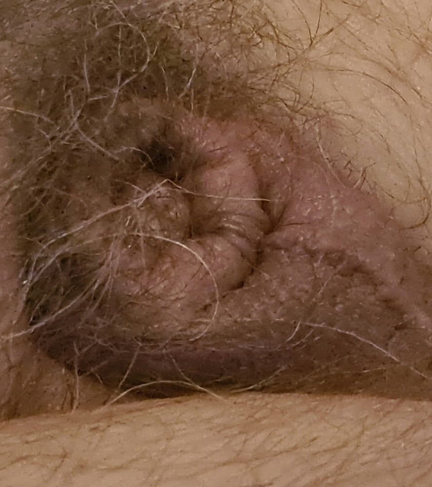 My small penis #2