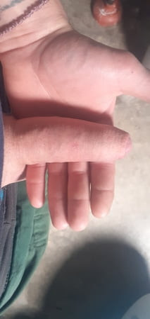 Penis