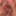 My foreskin #6