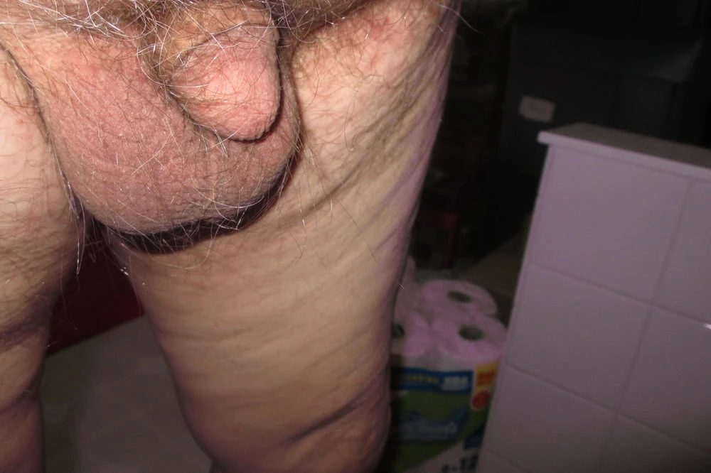the evolution of a shrinking penis #3