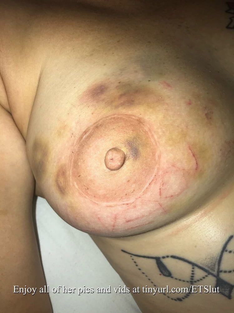 Tit Torture #36