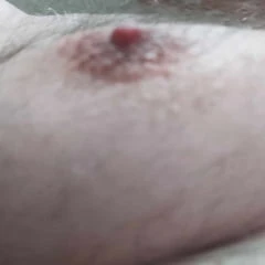 Tetas e mamilos