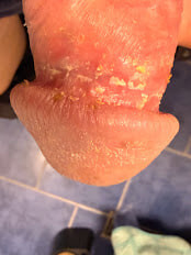 Acorn cheese or nub cheese