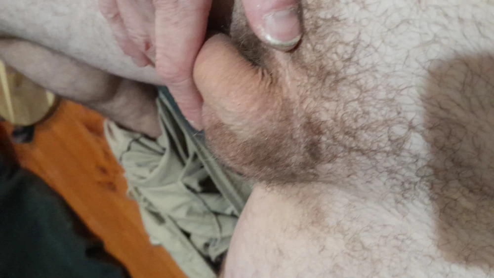 Phils sore balls  #2