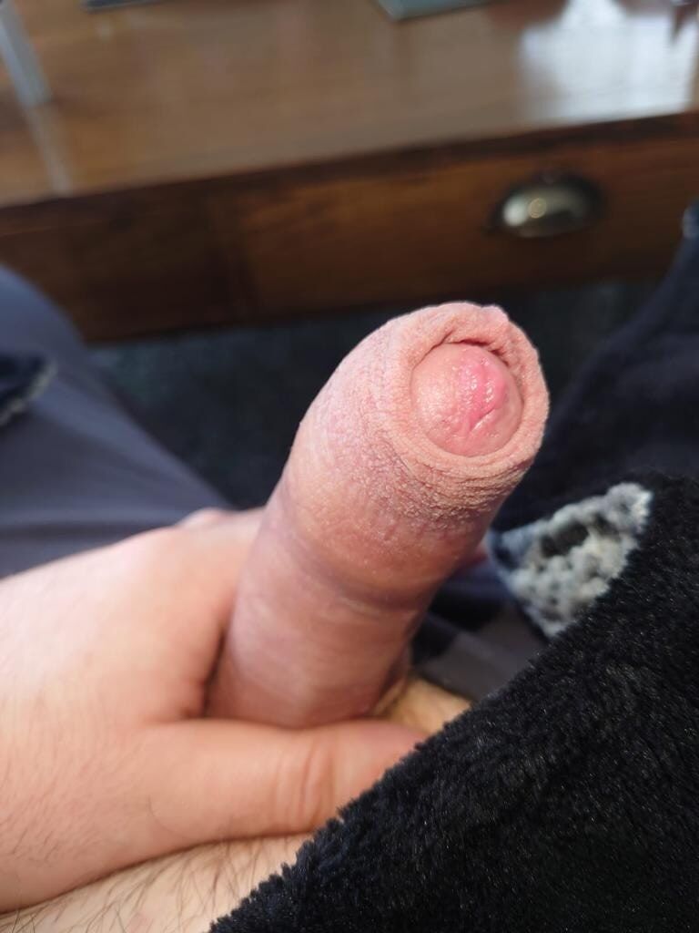 My Penis #13