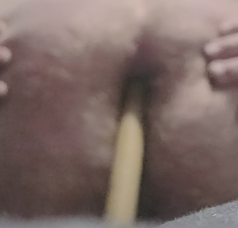 Tied balls and my hairy bum #9