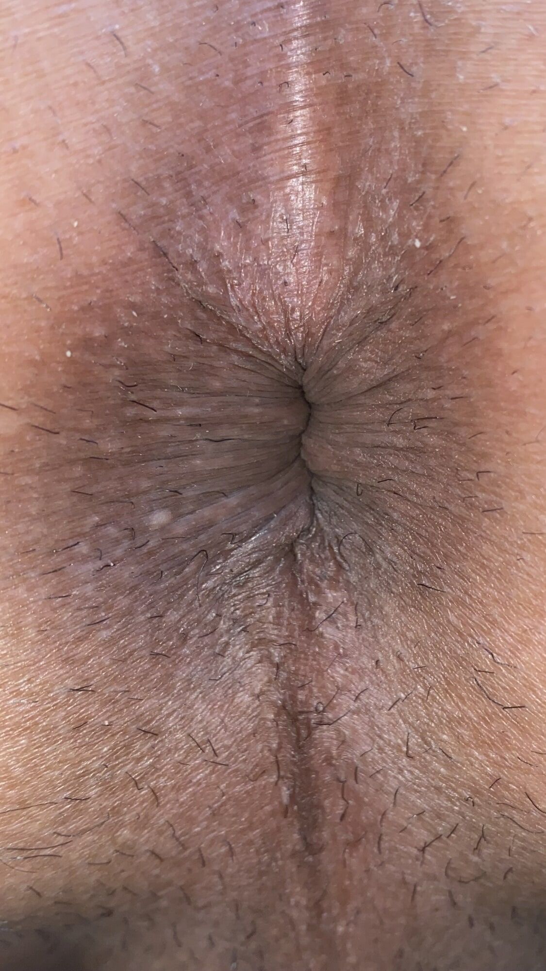 Close-up of a man's anus #15
