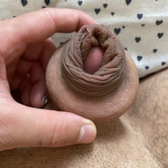 包皮用甜甜圈伸展