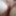 My labia