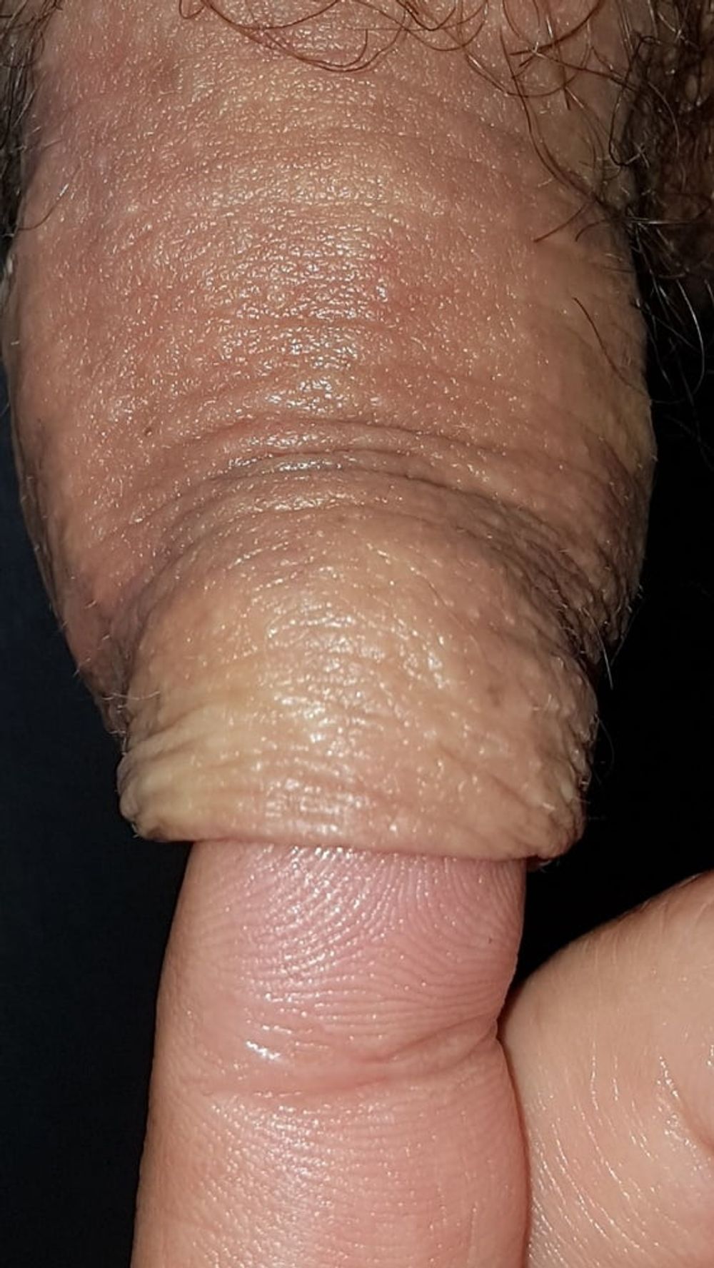 My foreskin #5