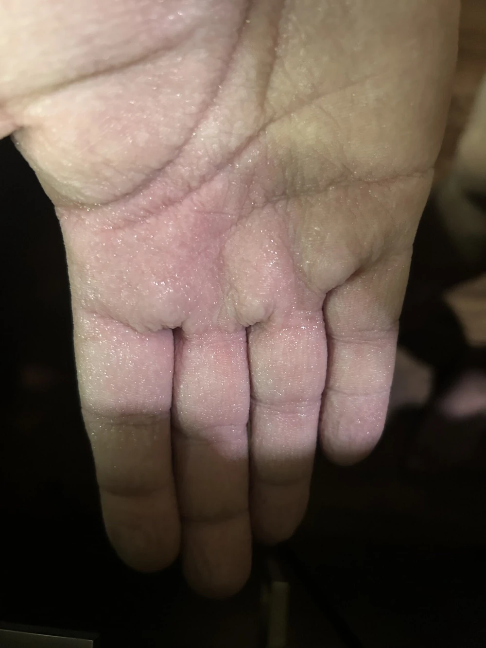 pruny