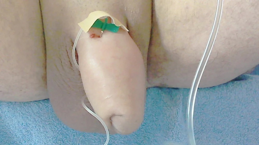 Saline fun #7