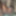 Micro cock, tiny penis pictures