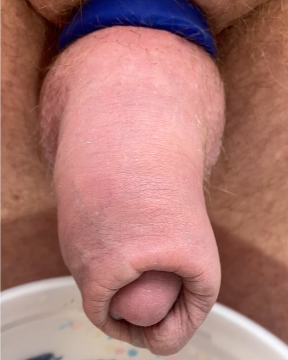 Compilation of uncut cock pics #37