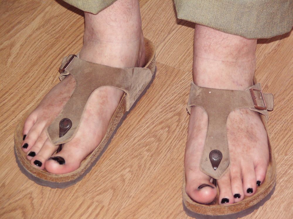 Birkenstock Feet #5