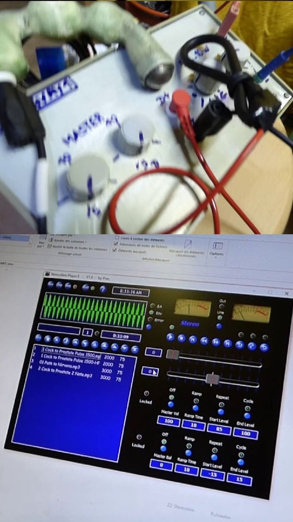 electro stimulation E-stim de paul #58