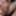 Fingering subincision deep #3