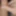 Foreskin 