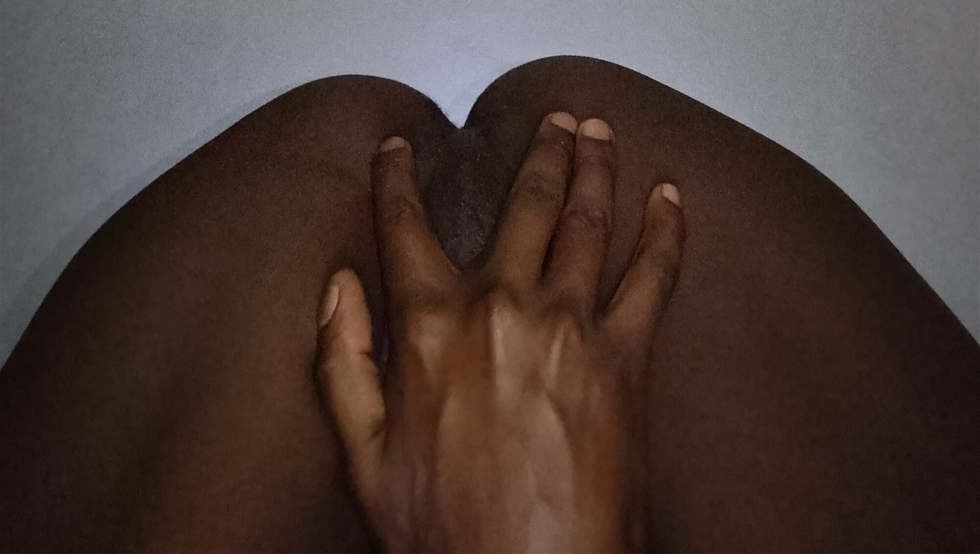 Cheeks too Dimplish #2