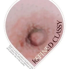 The nipple