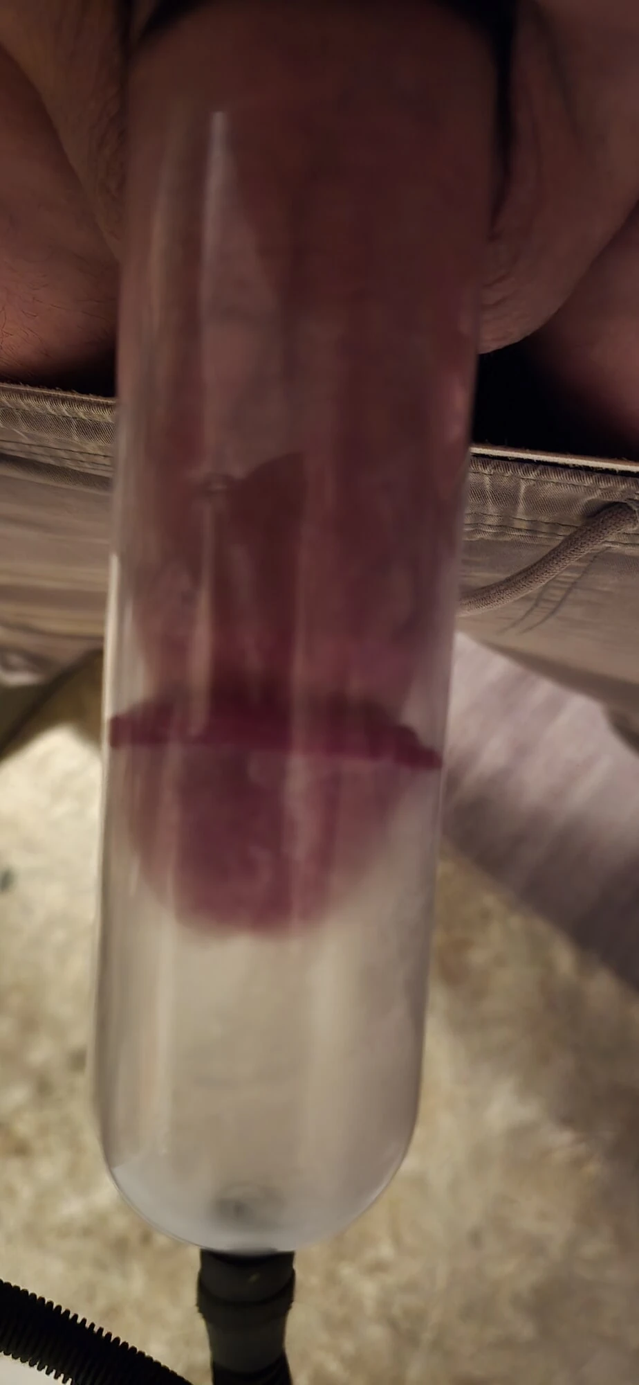 Penispumpe