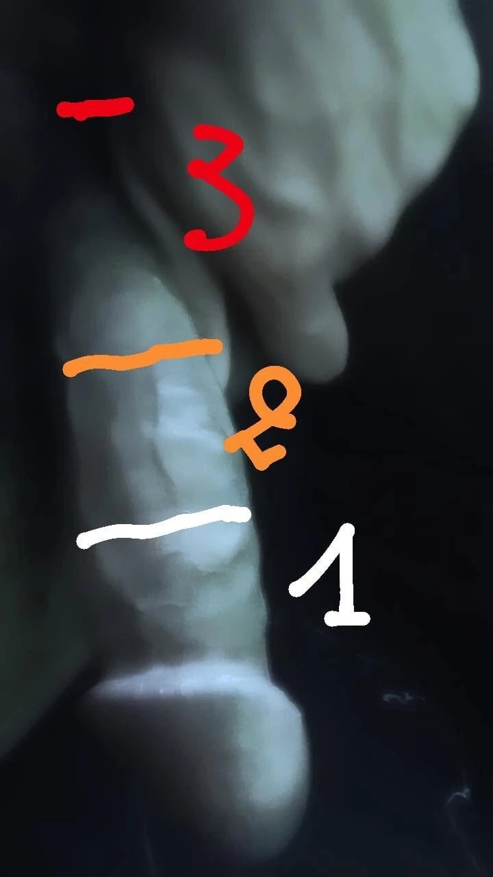 My penis size 